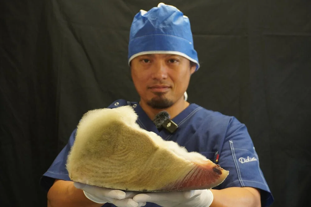 青い手術着と帽子を着用した男性が、動物の蹄のような解剖学的検体を持つ